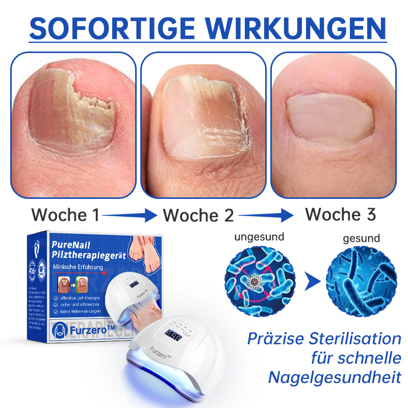 đFurzero⢠PureNail Pilz-Lasertherapiegerät