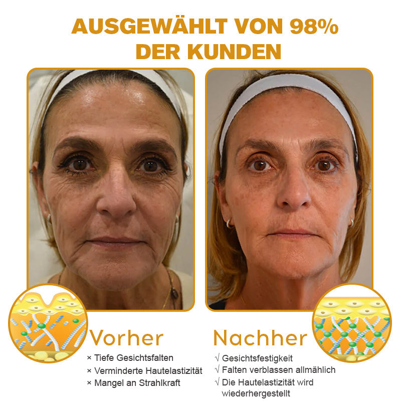 đđHergestellt in Deutschland - â¨Furzero⢠Botox Bienenvenom Faltenentfernungscreme
