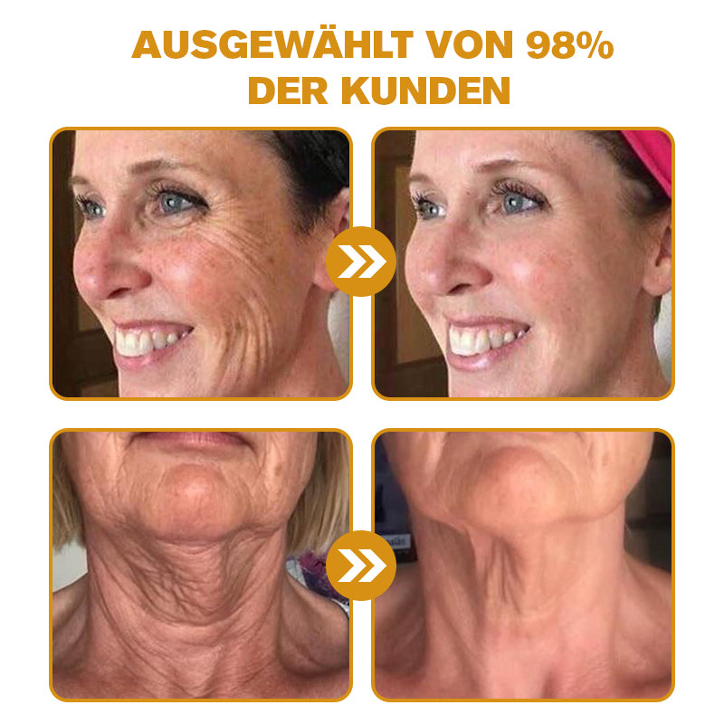 đđHergestellt in Deutschland - â¨Furzero⢠Botox Bienenvenom Faltenentfernungscreme