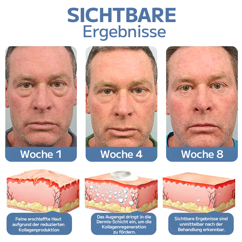👏OPENEYES Erwachen Peptid-Straffendes Augengel