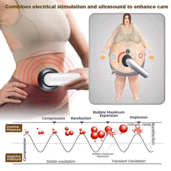 👨⚕️Furzero™ EMS-Ultraschall-Ferninfrarot-Anti-Cellulite-Massagegerät(👨⚕️Arztempfehlung)