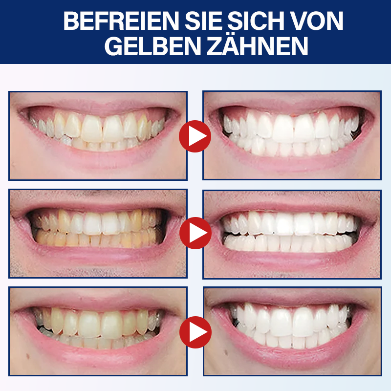 Furzero™ Medizinischer Serumstift zur Zahnaufhellung