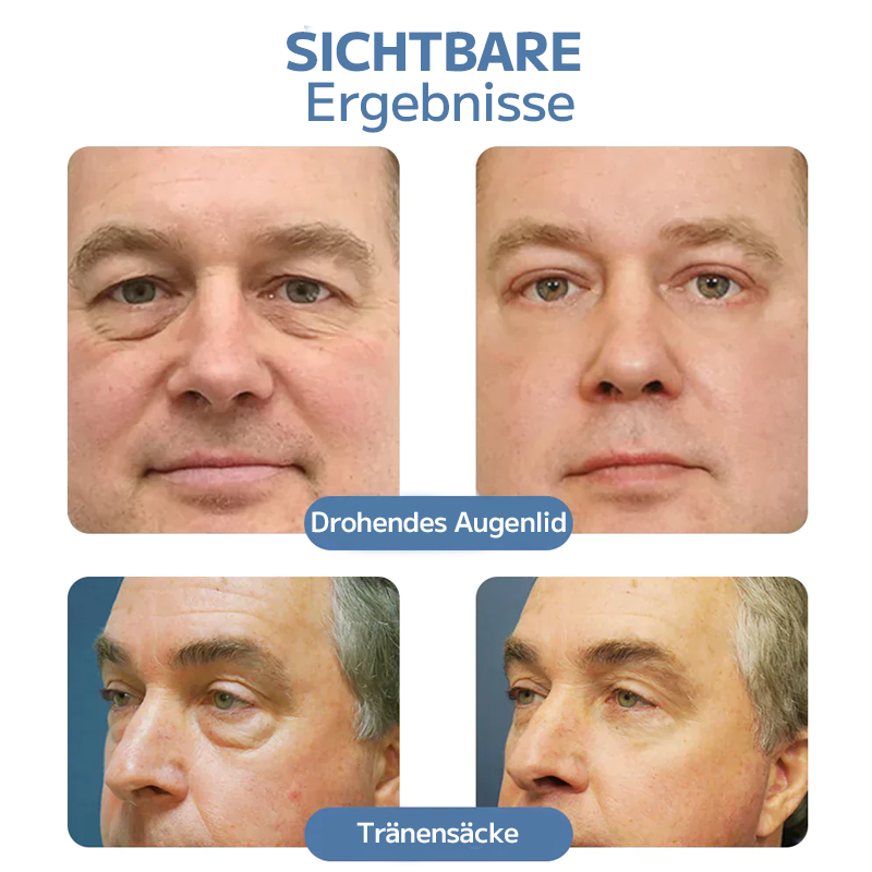 👏OPENEYES Erwachen Peptid-Straffendes Augengel