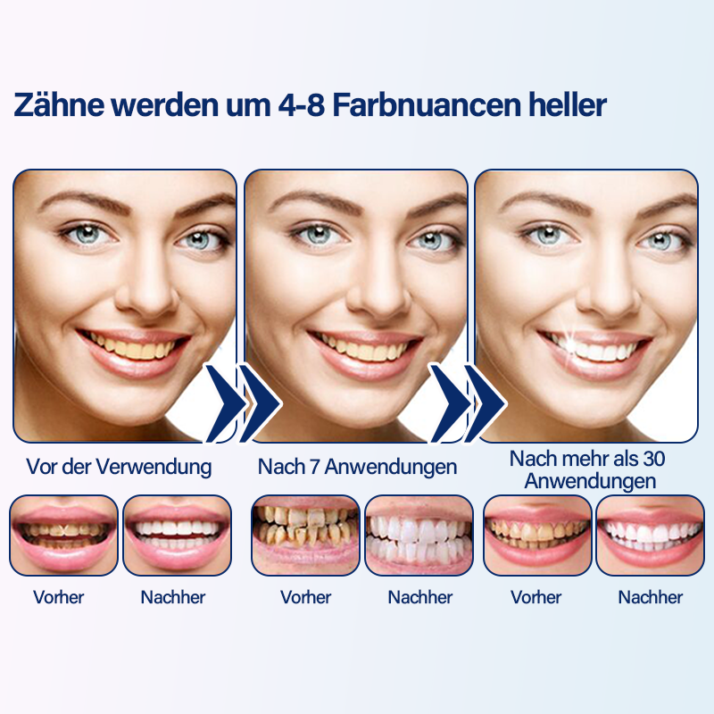 Furzero™ Medizinischer Serumstift zur Zahnaufhellung