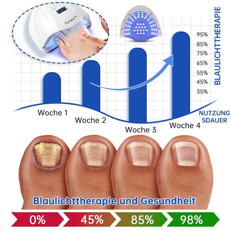 đFurzero⢠PureNail Pilz-Lasertherapiegerät