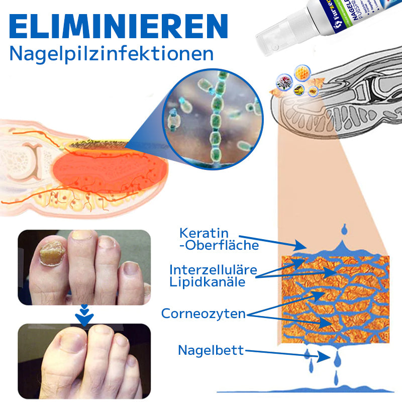 đ„ Furzeroâą Nagelpilz-FuĂspray