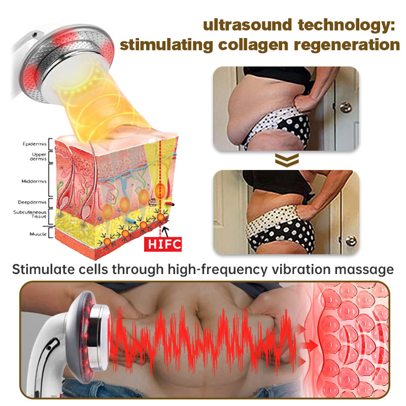 👨⚕️Furzero™ EMS-Ultraschall-Ferninfrarot-Anti-Cellulite-Massagegerät(👨⚕️Arztempfehlung)