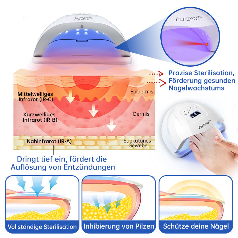 đFurzero⢠PureNail Pilz-Lasertherapiegerät