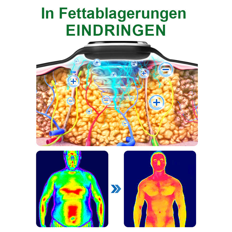 🥇🧑⚕️Futusly™ Ultraschall-Fettabbau und Entgiftungsarmband (🔥LETZTER TAG 70% RABATT)