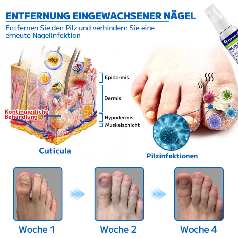 đ„ Furzeroâą Nagelpilz-FuĂspray