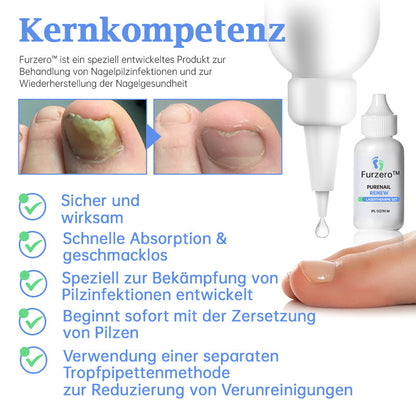 👏👍Furzero™ PureNail Pilz-Lasertherapiegerät