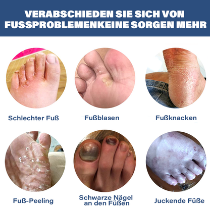 Furzero™ Medizinisches Nagelpilz Fußstärkungsspray