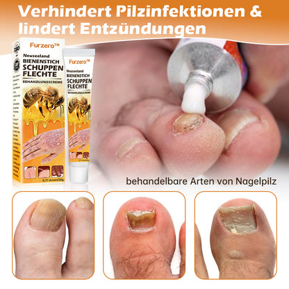 🐝Furzero™ Neuseeland Bienengift Psoriasis-Behandlungscreme (Geeignet für alle Hautbedingungen)