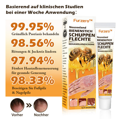 🐝Furzero™ Neuseeland Bienengift Psoriasis-Behandlungscreme (Geeignet für alle Hautbedingungen)