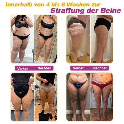 🐝Furzero™ BeeVenom Fettverbrennungscreme（Geeignet für schlaffe Haut nach Gewichtsverlust und postpartale Erschlaffung ）