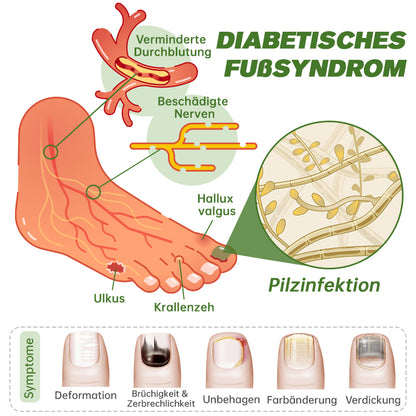 Furzero™ Medi-Care Anti-Pilz-Stick