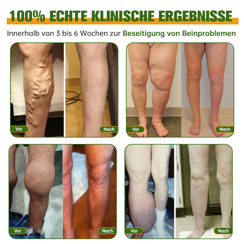 🐝Furzero™ Bienengift Lymphdrainage & Schlankheits-Fußbadperle -  Von NIH-Experten empfohlen