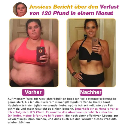 🐝Furzero™ BeeVenom Fettverbrennungscreme（Geeignet für schlaffe Haut nach Gewichtsverlust und postpartale Erschlaffung ）