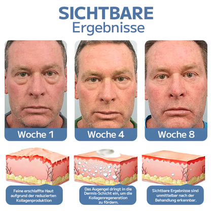 OPENEYES Erwachen Peptid-Straffendes Augengel TOP1