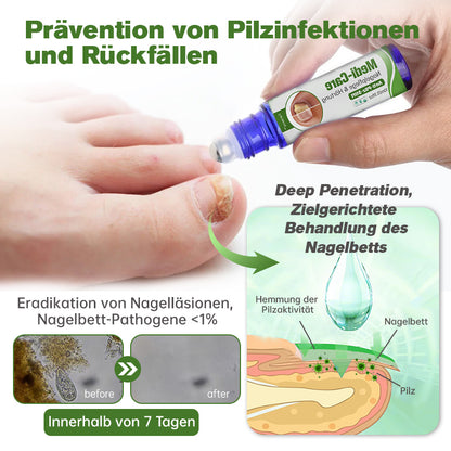 Furzero™ Medi-Care Anti-Pilz-Stick