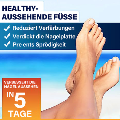 Furzero™ 5 Tage Zehennagelpilz Schnellreparaturstift
