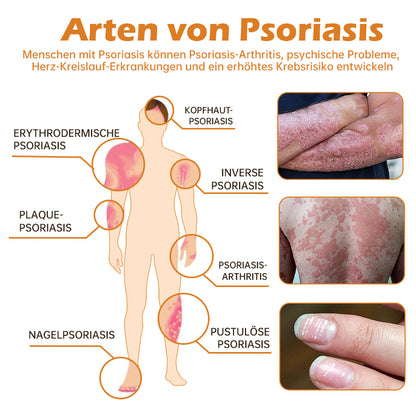 🐝Furzero™ Neuseeland Bienengift Psoriasis-Behandlungscreme (Geeignet für alle Hautbedingungen)