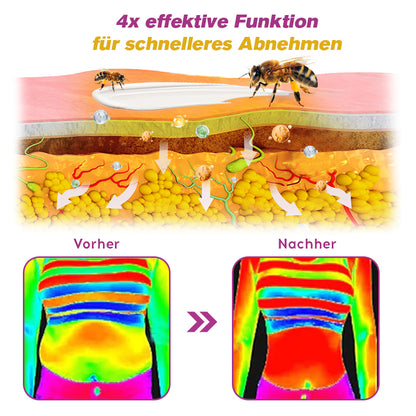 🐝Furzero™ BeeVenom Fettverbrennungscreme（Geeignet für schlaffe Haut nach Gewichtsverlust und postpartale Erschlaffung ）