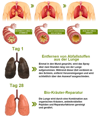 Furzero™ AtemDetox Lungenreinigungsspray Plus