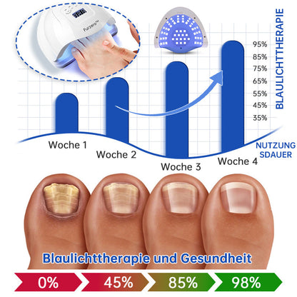 👏Furzero™ PureNail Pilz-Lasertherapiegerät
