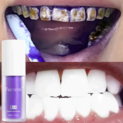 Furzero™ Rein pflanzliches Zahnweiß-Mousse