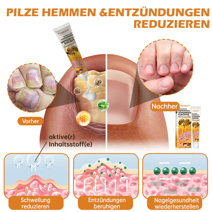 🐝Furzero™ Neuseeland Bienengift Psoriasis-Behandlungscreme (Geeignet für alle Hautbedingungen)