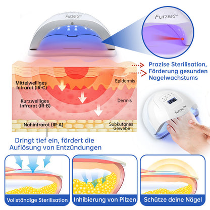 👏Furzero™ PureNail Pilz-Lasertherapiegerät