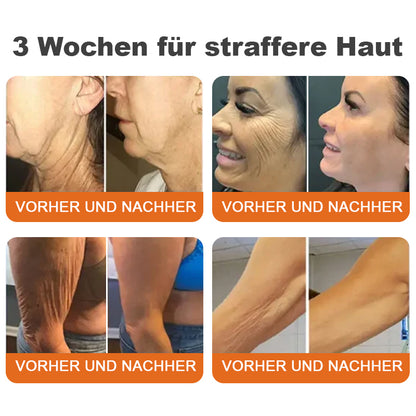 💎LETZTER TAG 70% RABATT✨Flysmus™ Botox-Bienenvergiftungsstraffungsserum-Stick🌿Hergestellt in Deutschland