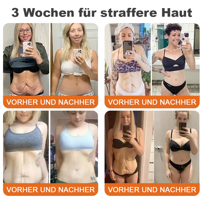 💎LETZTER TAG 70% RABATT✨Flysmus™ Botox-Bienenvergiftungsstraffungsserum-Stick🌿Hergestellt in Deutschland