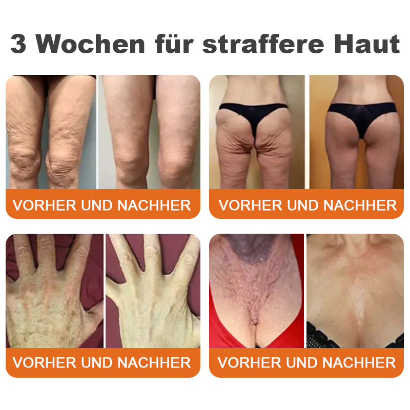 💎LETZTER TAG 70% RABATT✨Flysmus™ Botox-Bienenvergiftungsstraffungsserum-Stick🌿Hergestellt in Deutschland