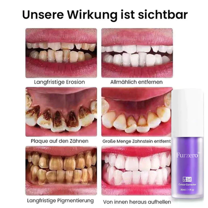 Furzero™ Rein pflanzliches Zahnweiß-Mousse