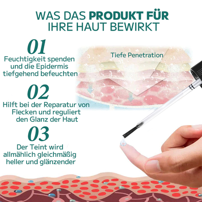 Furzero™ Warzen- und Muttermalentferner (Ermäßigung für begrenzte Zeit 🔥 letzter Tag)