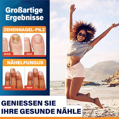 Furzero™ 5 Tage Zehennagelpilz Schnellreparaturstift