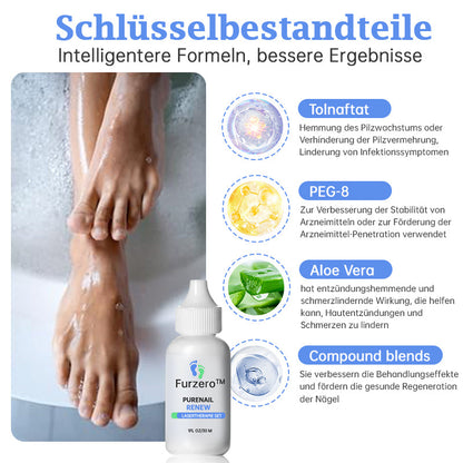 👏👍Furzero™ PureNail Pilz-Lasertherapiegerät