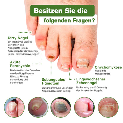 Furzero™ Medi-Care Anti-Pilz-Stick