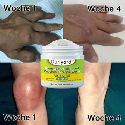 🍀Ourlyard™ Bienengift Gelenk- und Knochen-Therapie-Creme (Vollständige Körpererholung, reine natürliche Formel)