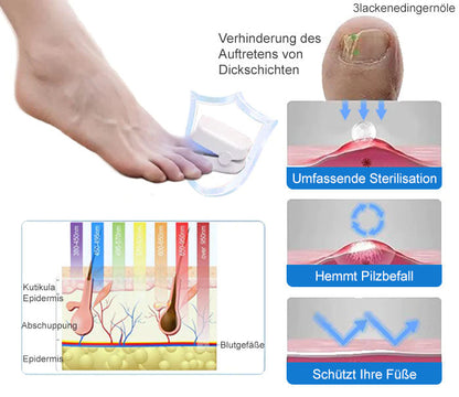Ourlyard™ Leistungsfähiges Lichttherapiegerät zur Behandlung von Nagelerkrankungen